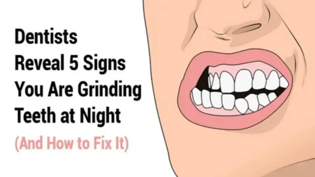 teeth names