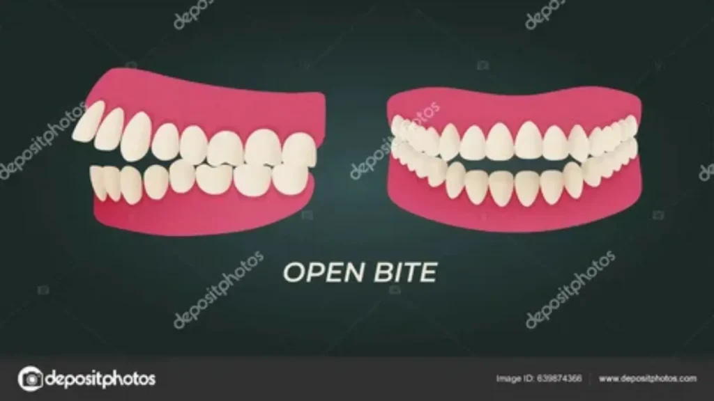 teeth names