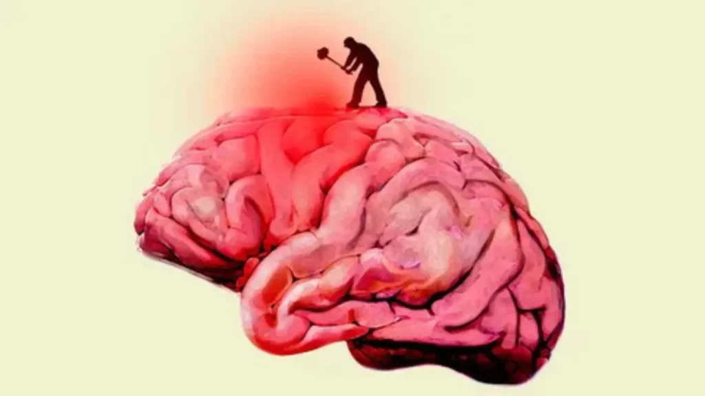 brainrot names
